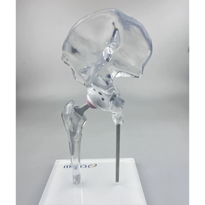 Kyrend पारदर्शी हिप संयुक्त इम्प्लांट मॉडल प्रतिस्थापन मॉडल मिनी आकार स्पष्ट जेनेरिक डिस्प्ले मॉडल - Product Image 6