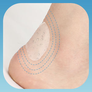 OEM plester pembalut hidrokoloid-perawatan Blister kaki profesional dengan penyembuhan luka canggih - Product Image 2