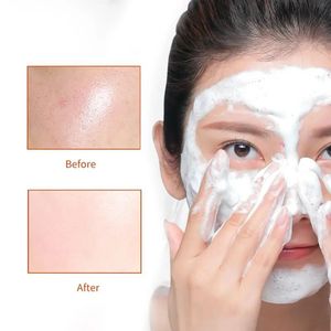 Tienda directa de fábrica, lavado de cara orgánico Natural, blanqueamiento antiacné, Limpieza Profunda, limpiador Facial espumoso de leche con vitamina E - Product Image 3