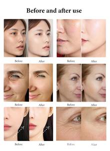 Meilleures Capsules d'Oxygène Nettoyantes pour la Peau 4 en 1, Machine à Bulles d'Oxygène CO2 pour le Visage, Analyse de la Peau, Soins du Visage pour Salon de Beauté, Spa, Clinique - Product Image 6