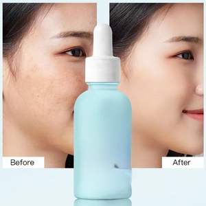 Suero de Escualano de Reparación Nocturna Avanzada para la Piel, Multiefectos, Aclara las Manchas Oscuras, Repara el Daño Solar, 100% Profundo - Product Image 4