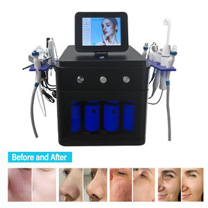 Appareil de peeling à l'oxygène Aqua 14 en 1, traitement des cicatrices d'acné, appareil d'élimination des points noirs - Product Image 3