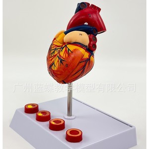 Modèle de cœur humain, modèle de cœur agrandi, modèle d'infarctus, modèle anatomique du cœur. - Product Image 2
