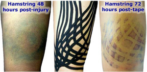 Carrera de campo Manténgase pegajoso más de 10 días cinta de kinesiología cinta muscular de la mejor calidad - Product Image 3