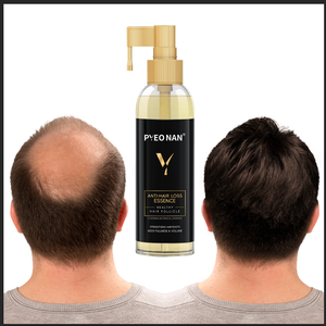 Ensemble d'huiles essentielles pour la prévention <span class=keywords><strong>de</strong></span> la perte <span class=keywords><strong>de</strong></span> cheveux, sérum et lotion anti-chute, traitement capillaire, huile <span class=keywords><strong>de</strong></span> croissance, sérum pour le cuir chevelu - Product Image 1