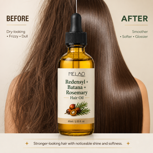 Aceite Capilar Redensyl Batana Romero con Logotipo Personalizado, 2.03oz, Belleza Natural, Brillo Ligero para Cuero Cabelludo con Clima Seco, Cuidado Inicial - Product Image 1