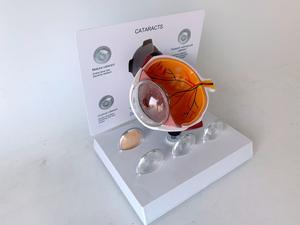 Recursos Didácticos Experimentales de Ciencias Médicas: Globo Ocular Humano, <span class=keywords><strong>Cataratas</strong></span>, Enfermedades Oculares, Pupila - Product Image 4