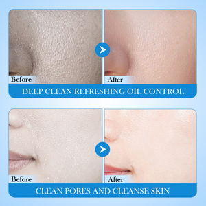 Limpiador Facial Hidratante con Manteca de Karité y Vaselina, Control de Grasa y Limpieza Profunda, Marca Privada OEM ODM FAYANKOU - Product Image 5