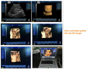 Sunbright à bas prix pour le diagnostic de l'ordinateur portable 15 pouces machine à ultrasons numérique <span class=keywords><strong>3D</strong></span> - Product Image 3