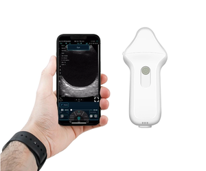 Probe <span class=keywords><strong>Ultrasound</strong></span> Portabel Nirkabel Mini 128 Elemen Frekuensi Tinggi untuk Mata - Product Image 5