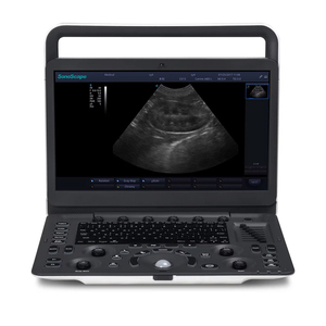 Ecógrafo Doppler Color Portátil Sonoscape E1V 3D 4D para Veterinaria, Perros, Gatos, Equinos, Bovinos, Pantalla LCD <span class=keywords><strong>de</strong></span> 15.6 Pulgadas, 6.5 kg, Veterinario, CE, Clínico - Product Image 6