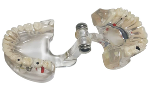 Modelo Dental de Dientes, Modelo de Dientes Transparente y Estándar para Enseñanza de Odontología, Demostración de Anatomía Oral - Product Image 4