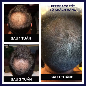 Huile d'Argan Naturelle & Aloe Vera Anti-Chute de Cheveux, Spray Liquide pour la Croissance des Cheveux, Huile pour la Croissance Rapide des Cheveux, Traitement du Cuir Chevelu et du Corps - Product Image 3