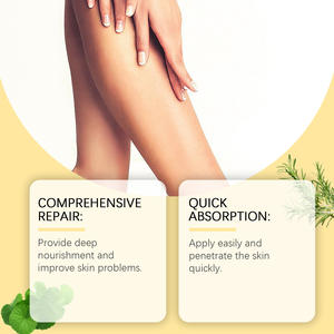 La Nueva Crema para el Alivio de las Várices en las Piernas a Bajo Precio es Fácil de Usar y Suave Sin Irritación. - Product Image 4