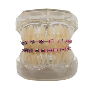 Modelo de Estudio de Ortodoncia Dental, Juego de 28 Dientes, Soportes Metálicos y de Cerámica, Resina para Demostración de Enseñanza - Product Image 1