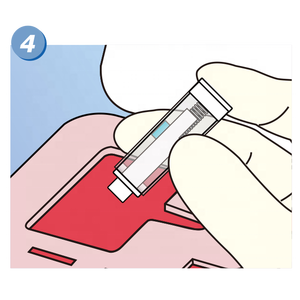 ทิ้งความปลอดภัยทางการแพทย์ <span class=keywords><strong>Lancet</strong></span> คุณภาพที่เหนือกว่าเข็มเก็บเลือดปลอดเชื้อ 21g 23g 28g 30g - Product Image 5