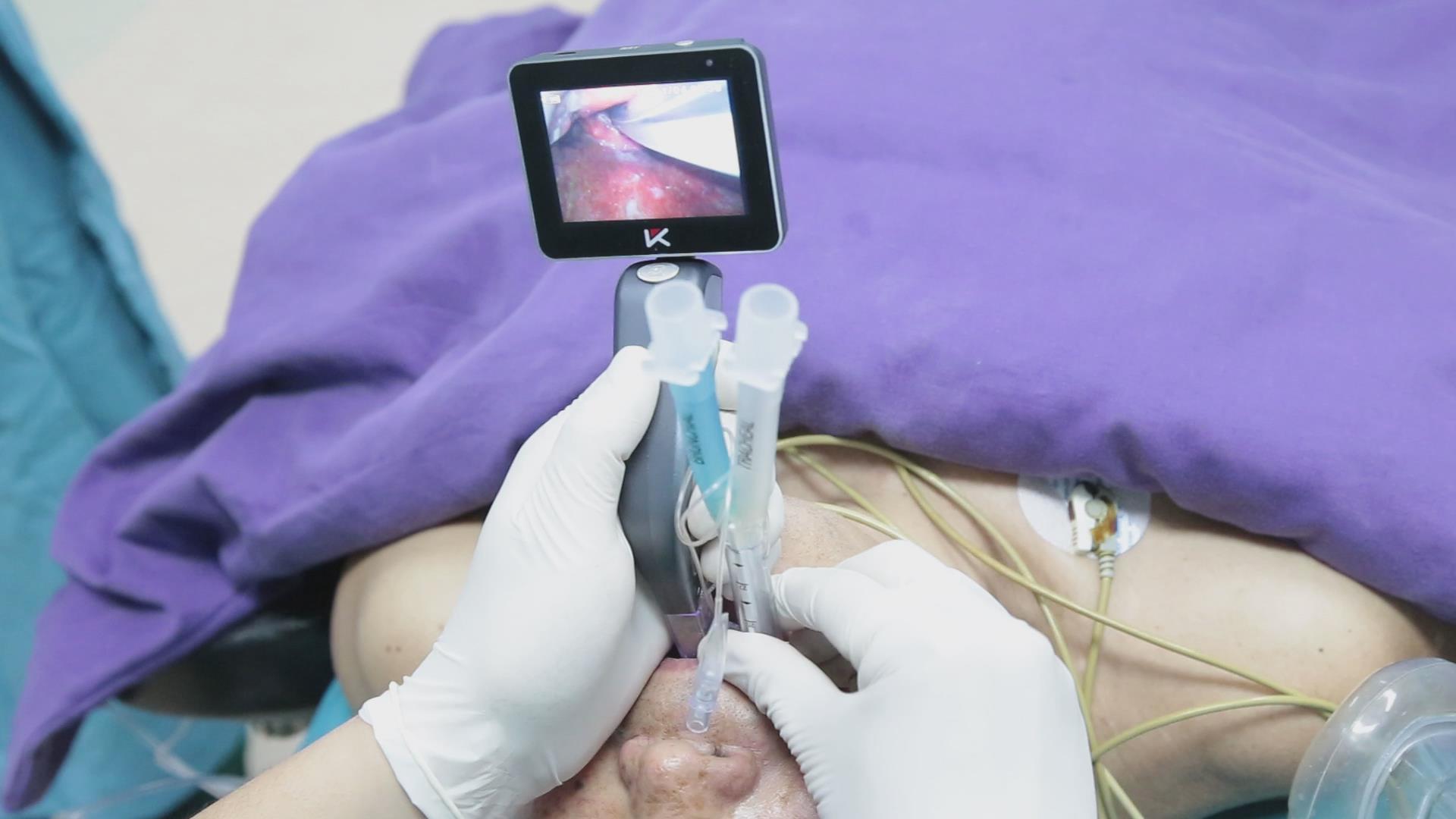 3" TFT OLED Surgical Handheld Video Laryngoscope 18650 Rechargeable