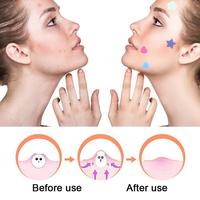 Patch absorbant invisible pour l'acné, patch facial hydrocolloïde pour les imperfections, sans cruauté animale