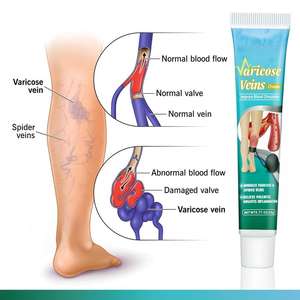 Ungüento para la Piel, Ungüento Tópico para la Piel, Crema para el Cuidado de la Piel, Ungüento para la Piel, Crema para la Circulación Sanguínea y <span class=keywords><strong>las</strong></span> <span class=keywords><strong>Venas</strong></span> Varicosas - Product Image 2