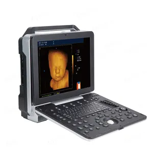 휴대용 컬러 도플러 4D 의료 초음파 스캐너