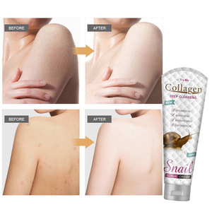 สครับหอยทากทำความสะอาดผิวหน้ารูขุมขนลดขนาดให้ความชุ่มชื้นและเพิ่มความกระจ่างใส - Product Image 1