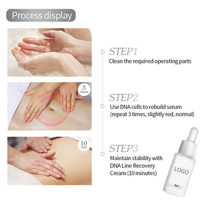 Crème PDRN puissante pour estomper les vergetures, lotion réparatrice post-partum pour la peau, atténue les cicatrices de grossesse - Product Image 5