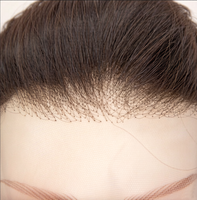 Perruque médicale en cheveux humains vierges européens, base en soie, entièrement en dentelle, sans colle, pré-épilée, pour l'alopécie et le cancer, HD transparente, densité 150%