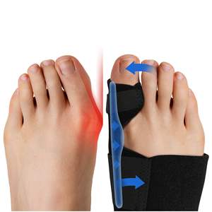 Corrector de Juanetes para <span class=keywords><strong>Dedos</strong></span> del Pie, Separador de <span class=keywords><strong>Dedos</strong></span>, Cuidado de los Pies, Corrector de Hallux Valgus - Product Image 1