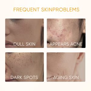 O volume antienvelhecimento do ODM do OEM desvanecer-se soro de clareamento do brilho dos pontos escuros 10% da vitamina C para a cara - Product Image 3