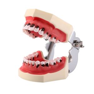 <span class=keywords><strong>Model</strong></span> Pengajaran Gigi Azdent <span class=keywords><strong>Model</strong></span> Kalkulus Gigi/ <span class=keywords><strong>Model</strong></span> Penyakit <span class=keywords><strong>Periodontal</strong></span> - Product Image 1