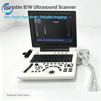 Appareil d'échographie portable numérique noir et blanc multifonctionnel pour le diagnostic en milieu hospitalier/clinique