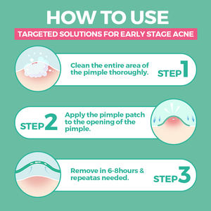 Parches Hidrocoloides para el Tratamiento del Acné, Parches para Granos <span class=keywords><strong>en</strong></span> <span class=keywords><strong>la</strong></span> <span class=keywords><strong>Frente</strong></span> y <span class=keywords><strong>la</strong></span> Nariz, Venta al por Mayor - Product Image 5