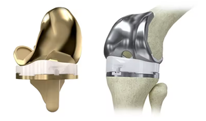 Sistema de Implante de Rodilla Cruciate Retaining para Uso Médico, Prótesis Articular, Prótesis de Rodilla CR - Product Image 2
