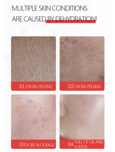 Huile de massage corporelle au curcuma Lovsens, huile essentielle pour le soin de la peau, apaisante, éclaircissante, rajeunissante, pour une peau éclatante et brillante - Product Image 5