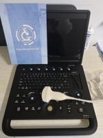 Échographe portable 3d obstétrique Gynécologie écho cardiaque couleur Doppler 3D échographie médicale