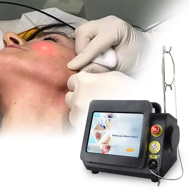 Etkili sonuç lazer lipoliz liposuction makinesi plastik cerrahi 1470 nm 980 nm endofiber lazer