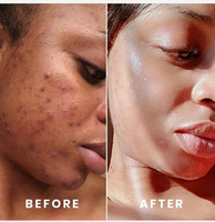 Sérum pour le visage éclaircissant à la vitamine C OEM, soin de la peau, sérum Piment Doux, sérum éclaircissant pour la peau, éclaircissant pour la peau noire