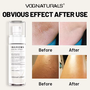Sérum en spray naturel pour poils incarnés sous marque privée – Réduit et élimine les boutons de <span class=keywords><strong>rasoir</strong></span>, apaise les irritations après épilation, traitement capillaire - Product Image 6