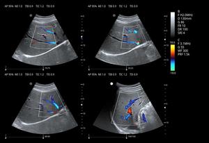 ZONCARE-ViV60 Échographe CDFI sur chariot avec écran LCD 3D/4D de 21,5 pouces + écran tactile haute sensibilité de 13,3 pouces pour radiologie, cardiologie, gynécologie - Product Image 5