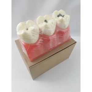 Modelo de dientes M4020 para práctica de caries, herramienta de entrenamiento dental con dientes desmontables - Product Image 4