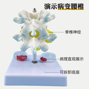 Modelo de cadera lumbar de cinco segmentos, modelo de columna vertebral, modelo de pelvis, modelo de esqueleto humano, disco intervertebral femoral - Product Image 2
