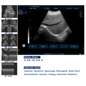 Máquina de escáner de ultrasonido digital portátil Sistema de diagnóstico ultrasónico para mujeres <span class=keywords><strong>embarazadas</strong></span> y perros Ser humano - Product Image 6