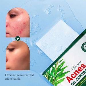 Masque anti-acné au thé vert SADOER, masque en feuille hydratant anti-acné pour les <span class=keywords><strong>étudiant</strong></span>s, produits de soin de la peau - Product Image 5