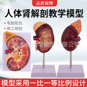 Modelo de anatomía del riñón humano, riñón y sistema urinario ampliados 2 veces, estructura del riñón y la glándula suprarrenal, modelo de riñón con enfermedades. - Product Image 3
