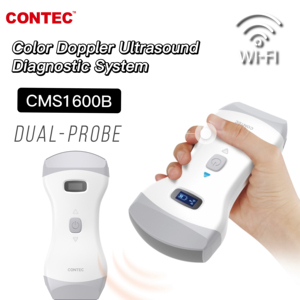 CONTEC-Máquina de diagnóstico por ultrasonido CMS1600B, sonda dual lineal/convexa - Product Image 4