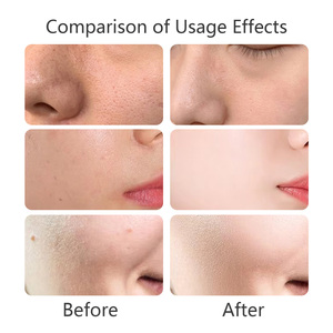 Tónico Facial con Ácido Glicólico al 7% al por Mayor para Aclarar el Tono de <span class=keywords><strong>Piel</strong></span>; Suero con Ácido Glicólico para Exfoliar y Minimizar los Poros - Product Image 5