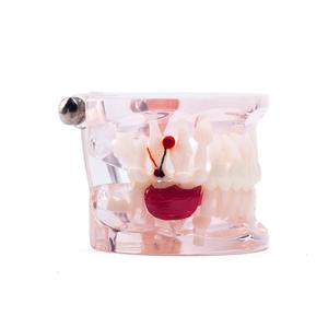 Gelsonlab HSDT-C8 Mixte Clair avec dents manquantes modèle de Dents Dentaires Pathologie Modèle D'étude Démonstration Modèle D'enseignement - Product Image 3