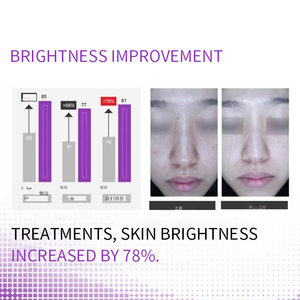 <span class=keywords><strong>Ampoules</strong></span> de poudre lyophilisée NAD+ Peptide anti-âge NAD Plus Peptide 100mg PDRN & NAD+ Peptide prêtes à être expédiées – Soin booster cutané - Product Image 5