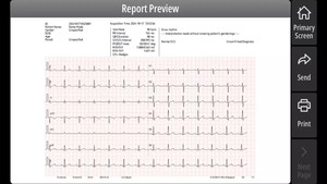 Électrocardiographe portable Mindray BeneHeart R300, appareil ECG 12 pistes Mindray avec écran 5 pouces pour usage vétérinaire - Product Image 5