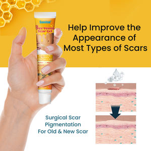 Crema de Silicona para Cicatrices con Vitamina E, Tratamiento Nutritivo para Todo Tipo de Cicatrices, 20g, 2 Años de Duración - Product Image 6